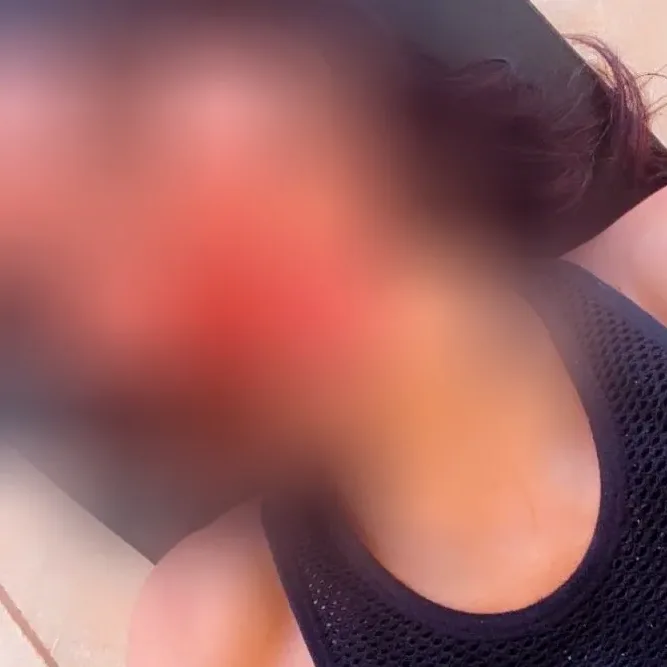 Hanna, 29